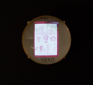 Próximo à escultura, um antigo slide médico apresenta a o sistema reprodutor feminino e as causas patológicas do sangramento uterino. “Causas de Hemorragia Uterina” – slide médico, <i>backlight</i> e lupa; 35 x 35 x 10 cm; 2018. 