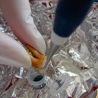 คราบพลั๊กบนฟันทีสะสมมากว่าหลายร้อยปีนั้นบอกอะไรมากมายเกี่ยวกับการกินอาหารของบรรพบุรุษของเรา 