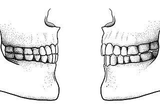 Zahnstellung