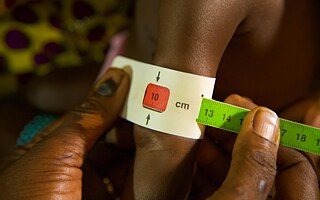 Bei der sichtlich schwachen und gebrechlichen 8 Monate alten Awa Tamboura wird im Referenzgesundheitszentrum in Bamako Coura der Unterarmumfang gemessen. Bei der Aufnahme wog sie nur 4 kg. Bamako, Mali, September 2018.