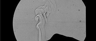 Textured grey orb on black background