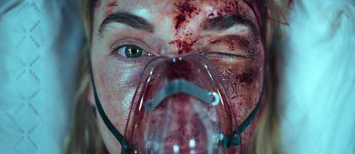 Nahaufnahme von "Lena" (dargestellt von Kim Riedle als Protagonistin von "Liebes Kind"), die ihr mit Prellungen übersätes Gesicht unter einer Sauerstoffmaske zeigt.