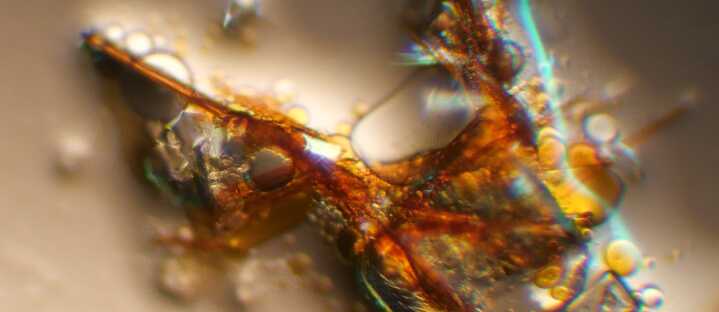 New Microscopies