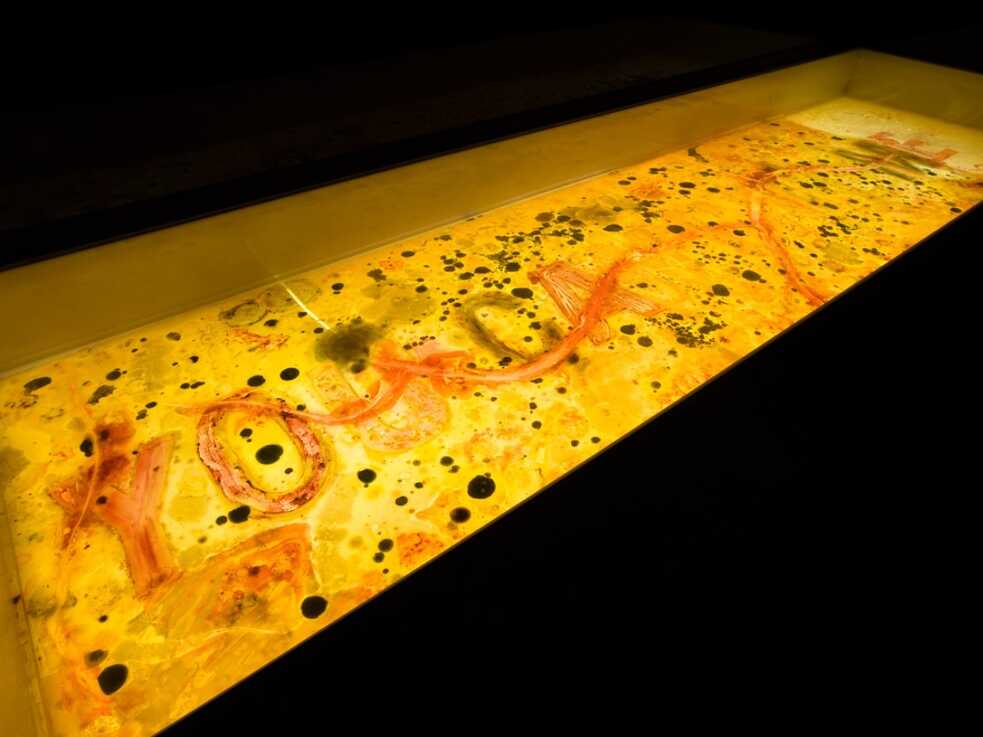 Plexiglas, Agar, weibliche Bakterien, Pilze