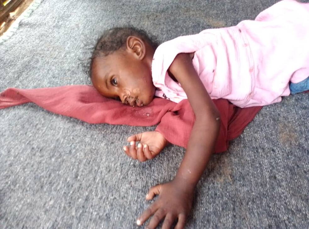 Ein kleines Mädchen liegt seitlich auf dem Boden. Sie trägt ein rosa T-Shirt. Sie ist unterernährt. 