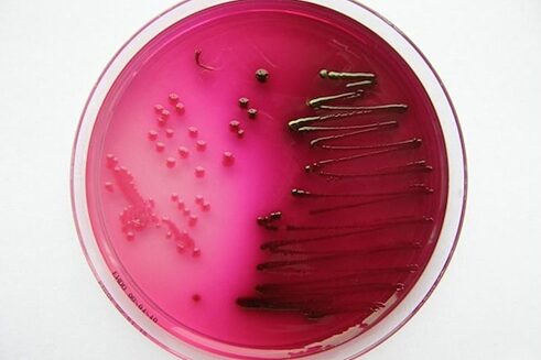 Esta sustancia gelatinosa proveniente de las algas ha sido un producto revolucionario en la microbiología. Descubierto en el siglo XV después de que un japonés encontrara convertida en gel su sopa de algas del día anterior, el agar ha sido utilizado como ingrediente culinario y para hacer plastilina. Pero el uso más significativo ha sido la producción de placas petri, empleadas en el cultivo de bacterias para el estudio de su comportamiento. (Foto: Cultivo en agar de la bacteria E. coli – PD.)