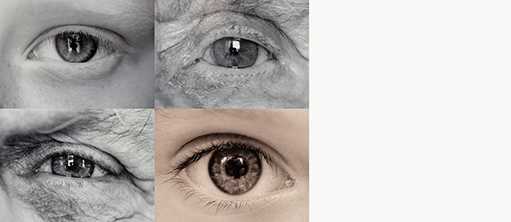 Augen