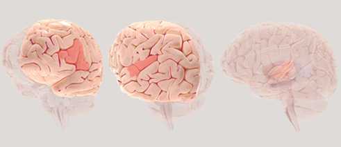 Sprachzentren im Gehirn. Links: die Broca-Region (Sprachproduktion), Mitte: die Wernicke-Region (Sprachverständnis), rechts: der primäre auditorische Cortex (Verarbeitung eingehender Sprachsignale). Klicken Sie auf die Bilder, um zu interaktiven Gehirnmodellen zu gelangen und weitere Informationen zu diesen Regionen zu erhalten. 