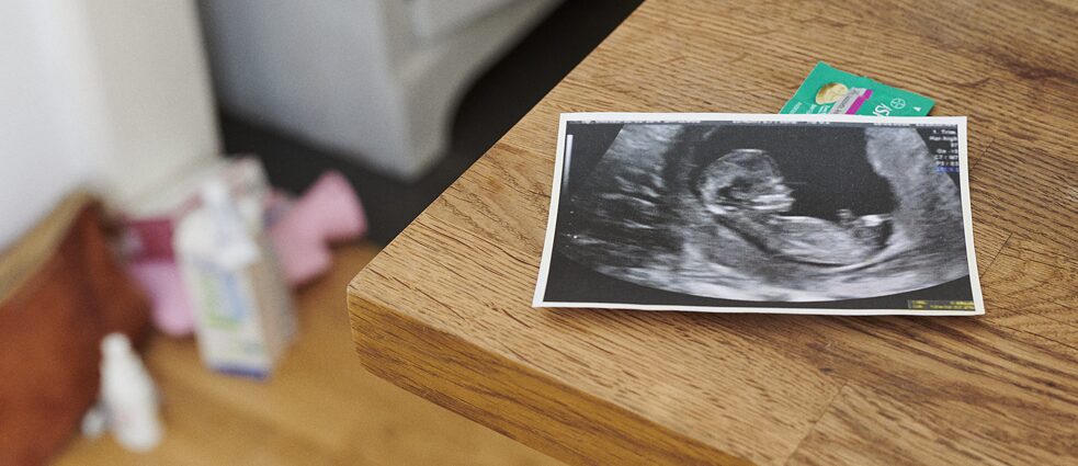 Auf einem Tisch liegt ein Ultraschallbild eines Ungeborenen.