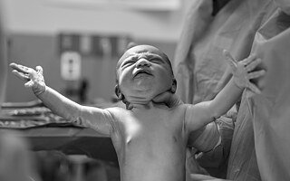 Pôrodní asistenti: „Nechceme byť nič extra“