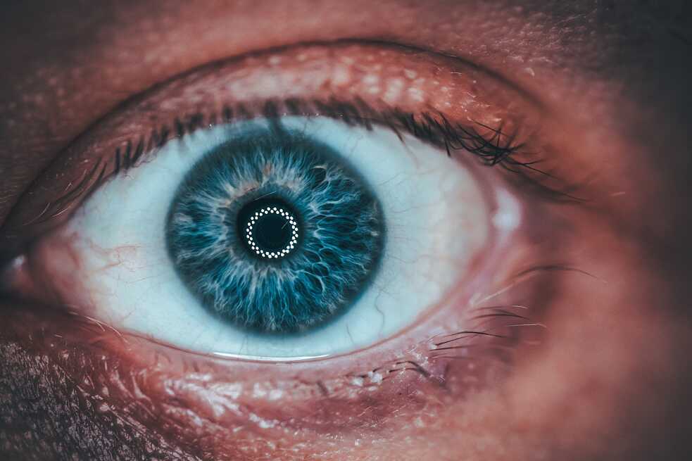 Kontaktlinsen – Keine normale Brille