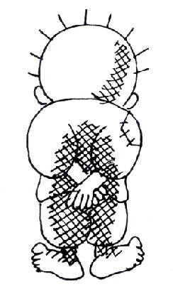 Handala, símbolo nacional palestino do “direito ao retorno” 