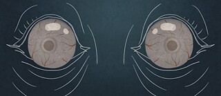 I do not sleep How did Corona increase the suffering of patients with "sleep disorders"?