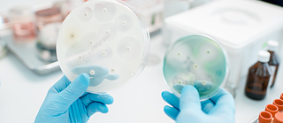 Bacteria with Antibiotics in Petri Dish
